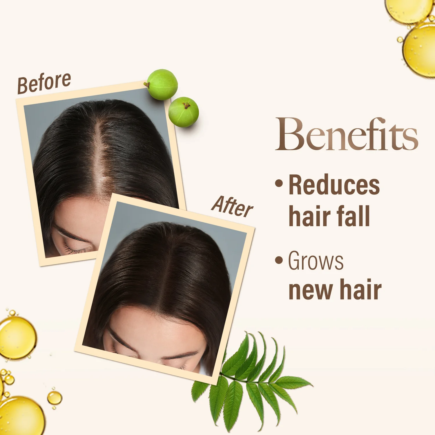 زيت كيش كينغ الطبي الأيورفيدي – يقلل من تساقط الشعر ويحفّز نموه